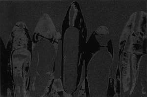 Andy Warhol - Diamond Dust Shoes  Complete Portfolio (F.S. II 248 - 252), (Deluxe Edition)