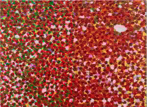 Damien Hirst - H4-7 Ryoanji