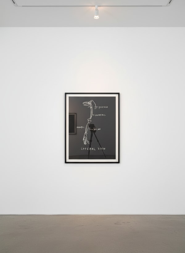 Jean-Michel Basquiat - Lateral View, from Anatomy, 1982