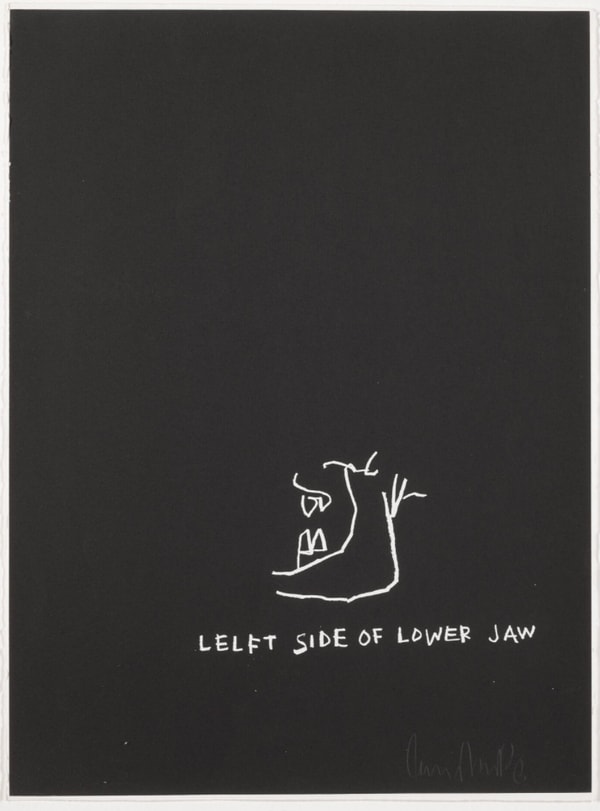 Jean-Michel Basquiat - Left Side of Lower Jaw, from Anatomy, 1982