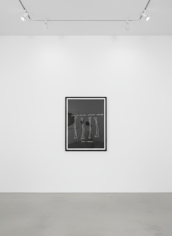 Right Humerus, from Anatomy