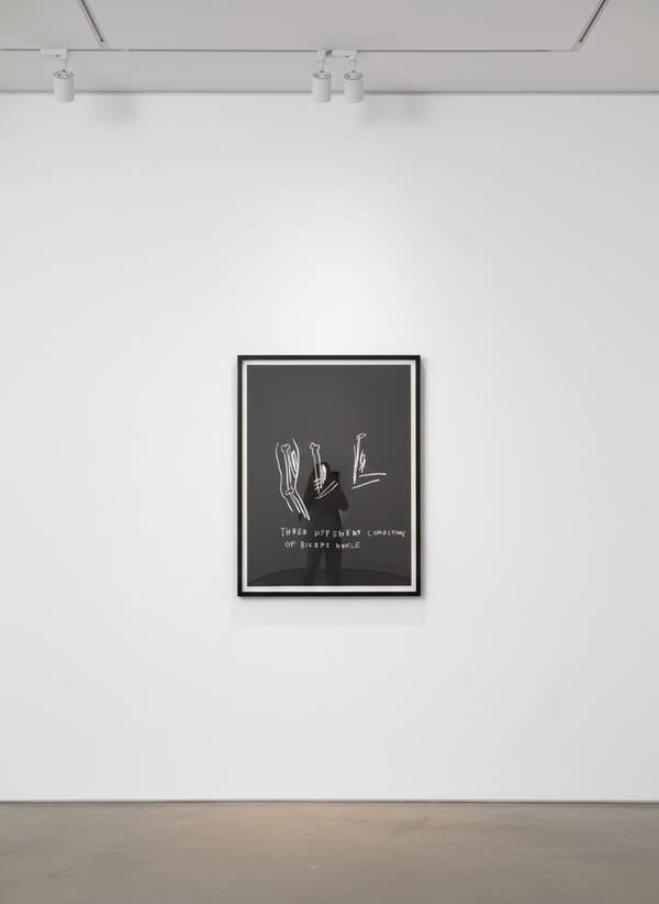 Jean-Michel Basquiat - Three Different Conditions of Biceps Muscle, from Anatomy, 1982, Screen print