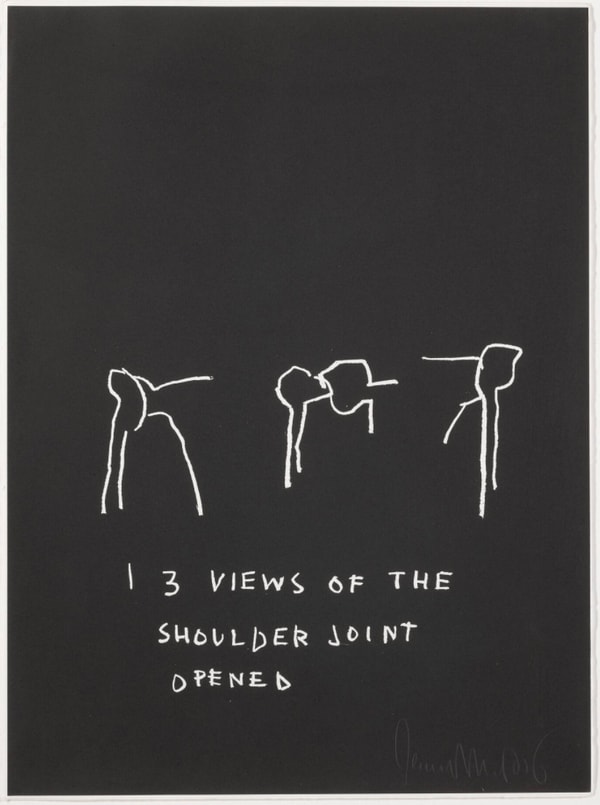 Jean-Michel Basquiat - Three Views of The Shoulder Joint Opened, from Anatomy, 1982
