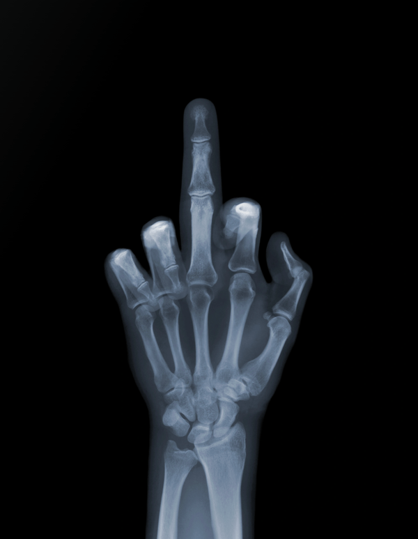 Nick Veasey - The Finger, 2001